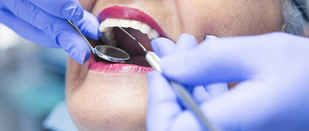 Best Emergency Dental Care for Broken or Chipped Teeth in Dolton, IL